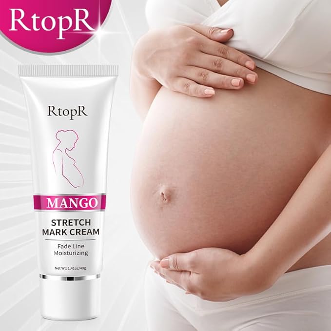 RtopR Mango Stretch Mark Cream Moisturizing