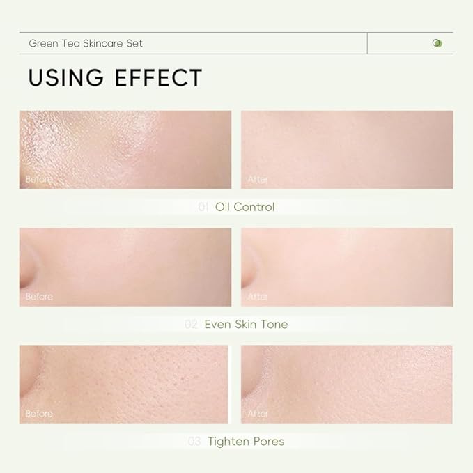 Skin Care Set, Green Tea Skin