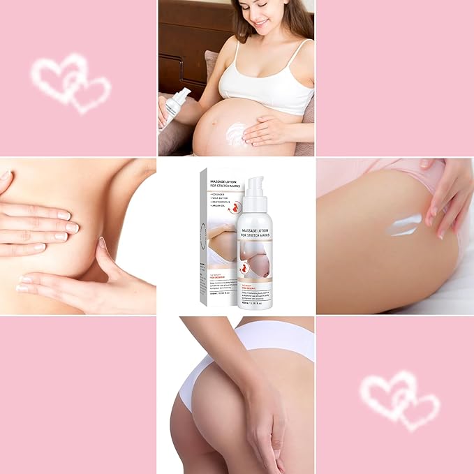 Stretch Mark Cream for Pregnancy - Brightening