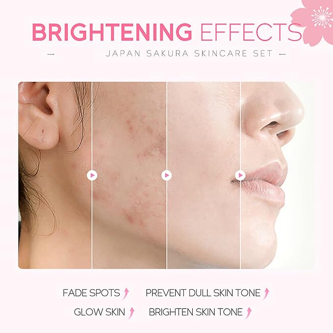 Skincare Gifts For Teenage Girls,Cherry Blossom