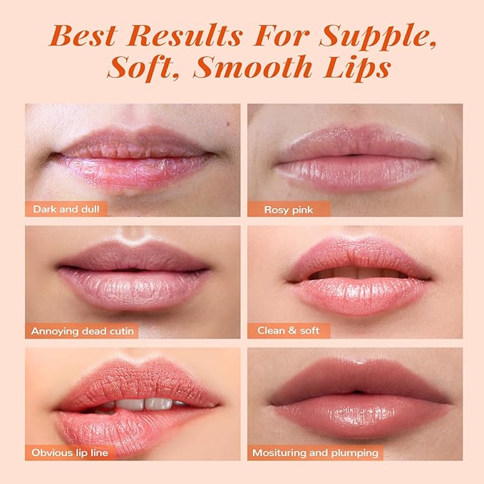 ANAI RUI Lip Balm Mask & Lines,