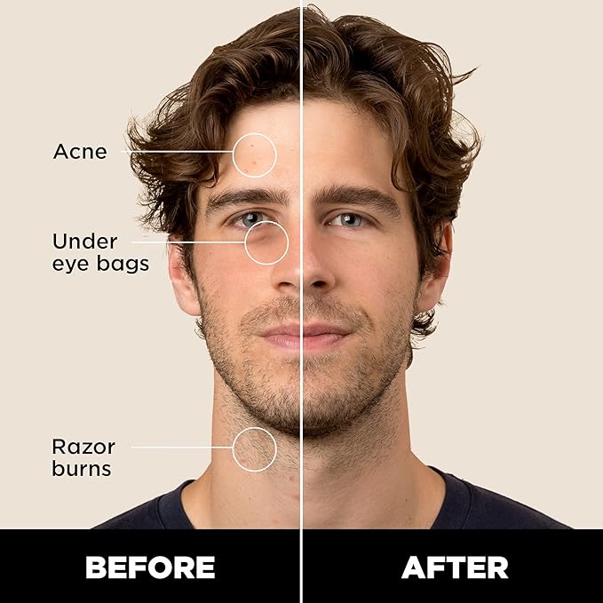 Stryx Concealer Stick Tool for Men, Light Cognac Skin Tones