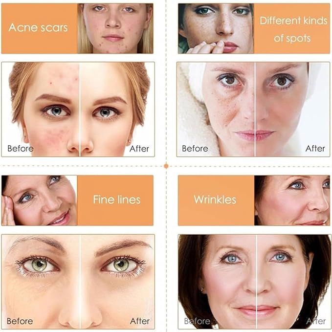 Vitamin C Skin Care Sets, 6Pcs Hydrating