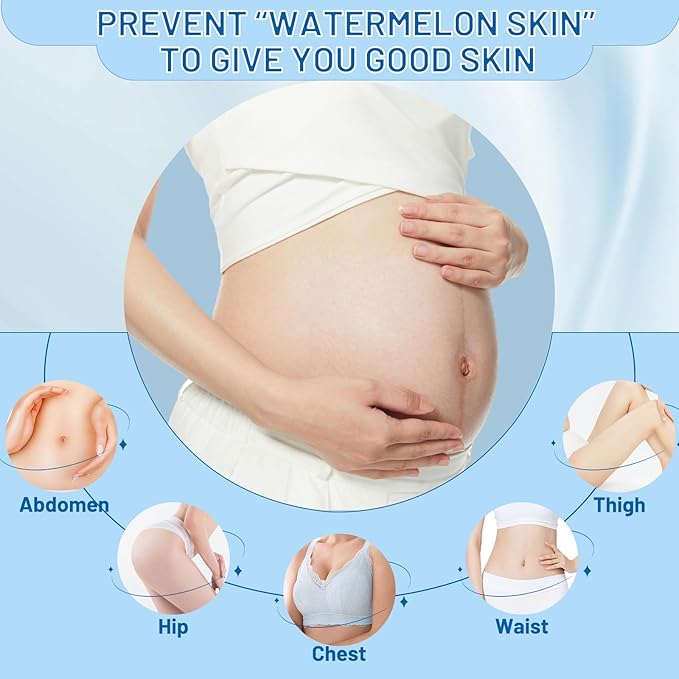 Stretch Mark Removal, Stretch Mark Cream