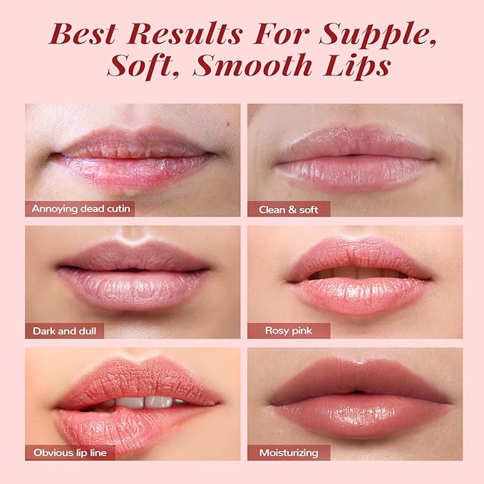 Lip Balm & Moisturizer Set, Lip Lips,
