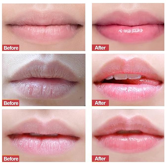 Lip Scrub, Exfoliator & Moisturizer, Lip