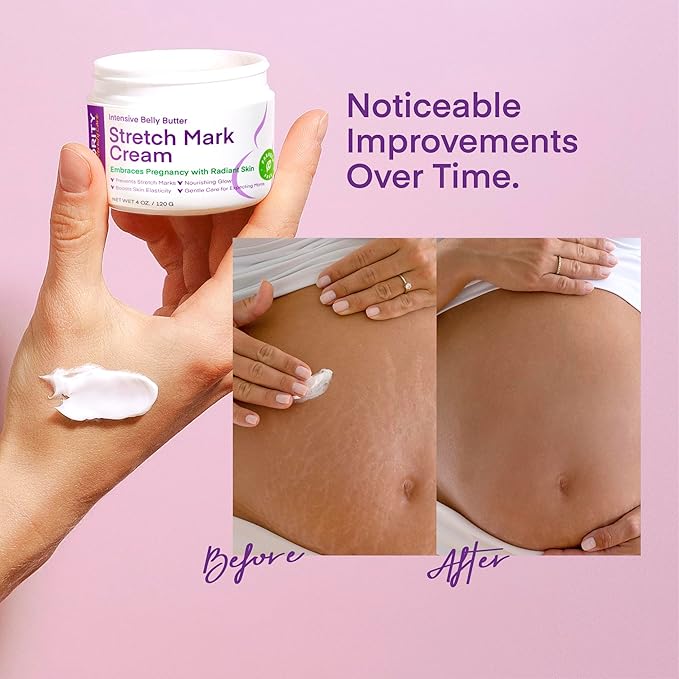 Stretch Mark Cream for Pregnancy: Stretch