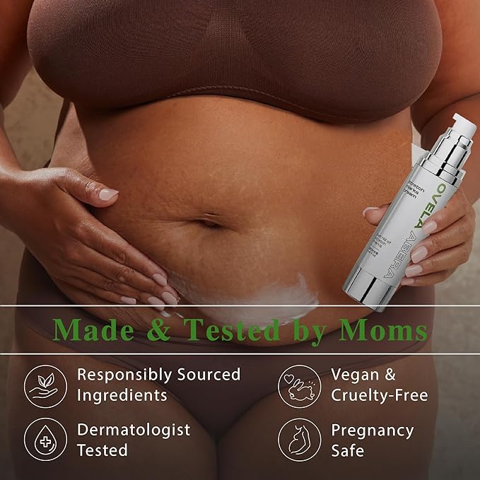 Abera Ovela Maternity Stretch Mark Cream oz