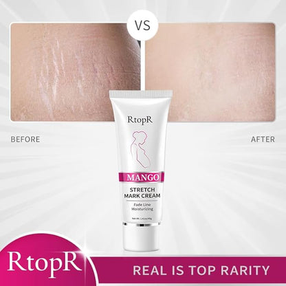 RtopR Mango Stretch Mark Cream Moisturizing
