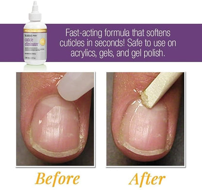 ProLinc Cuticle Eliminator, Softens and