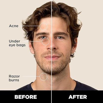 Stryx Concealer Stick Tool for Men, Light Cognac Skin Tones