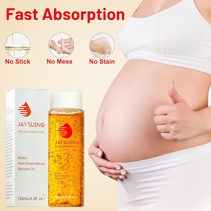 Stretch Mark Cream Stretch Mark Oil Fl.oz