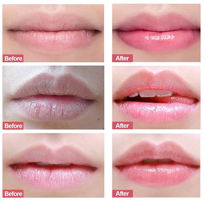Lip Scrubs Exfoliator & Moisturizer, Lip
