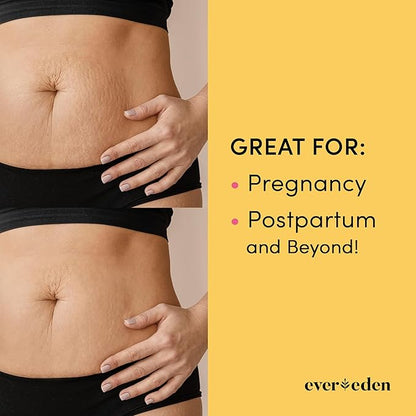Evereden Nourishing Stretch Mark Cream 50ml