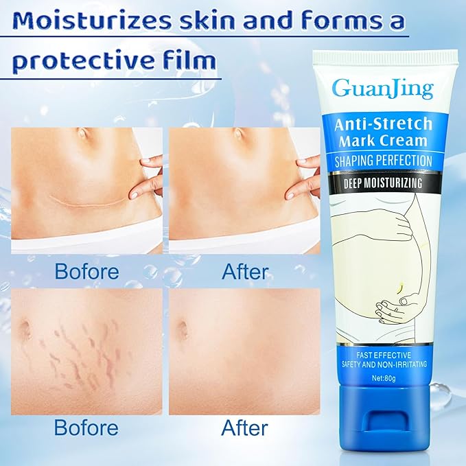 Stretch Mark Cream Stretch Mark Oil Fl.oz